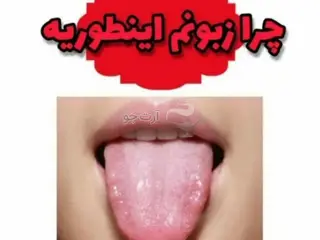 تشخيص بیماری