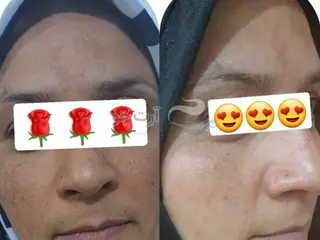 پک پاک سازی کبد
